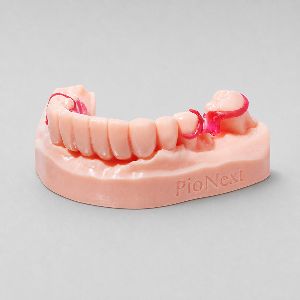 Dental Casting Resin application 1