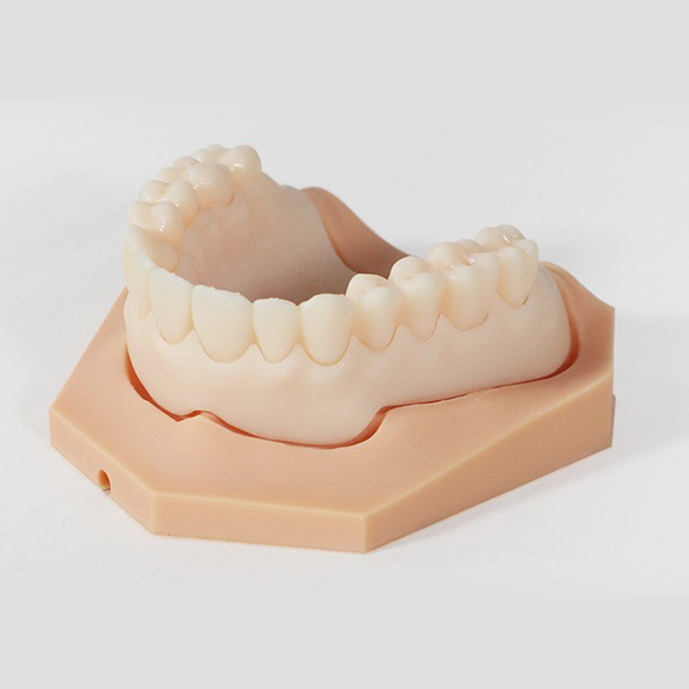 Try-in Resin application 1