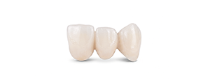 Temporary Restoration Resin