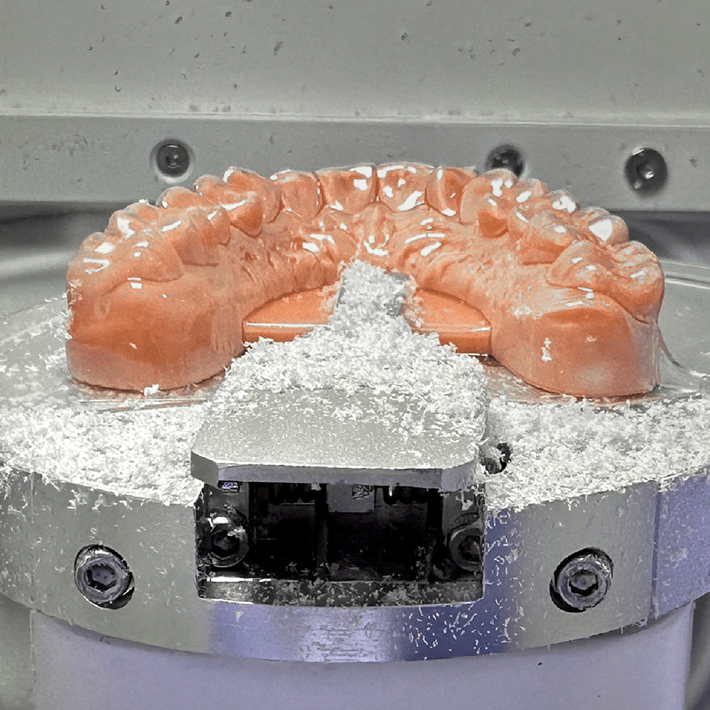 Ortho Model 2.0 Resin application 3