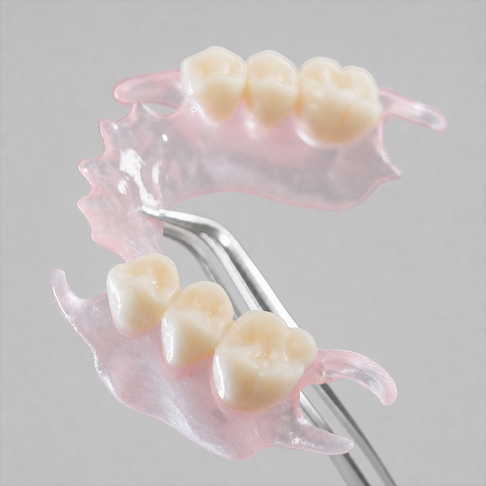 Crown & Bridge Resin application 3