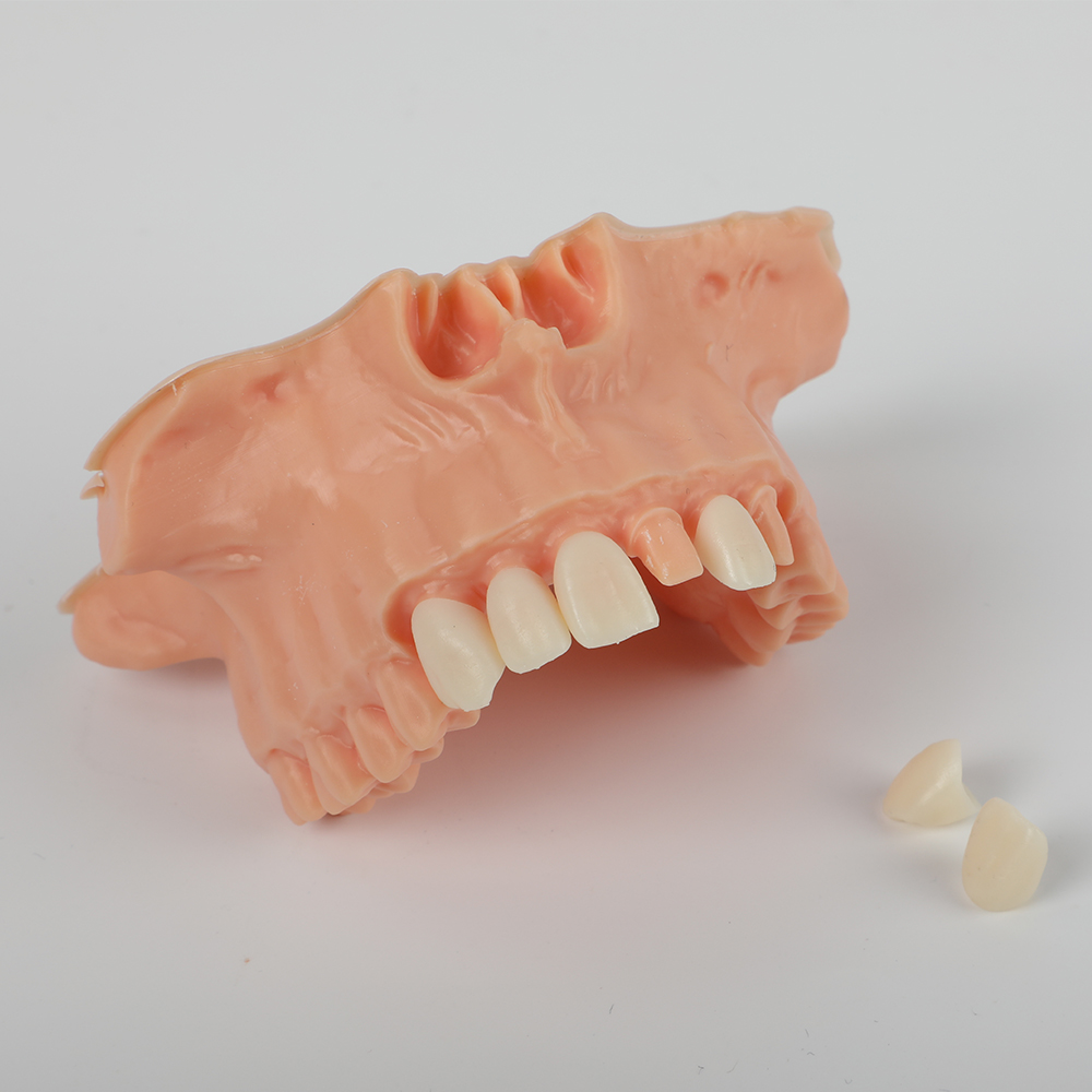Removable Die Model Resin application 2