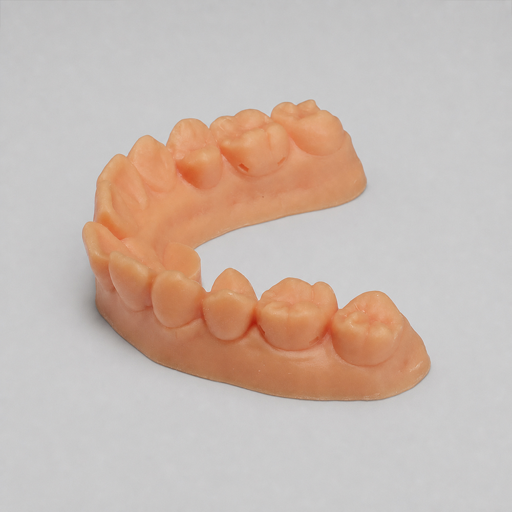 Ortho Model 2.0 Resin application 2