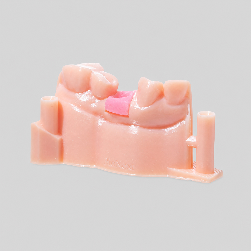 Gingiva Resin application 1