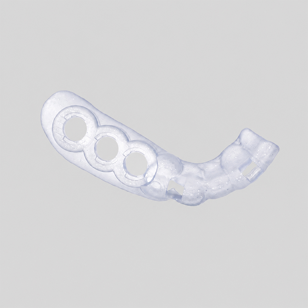 Surgical Guide Resin application 2