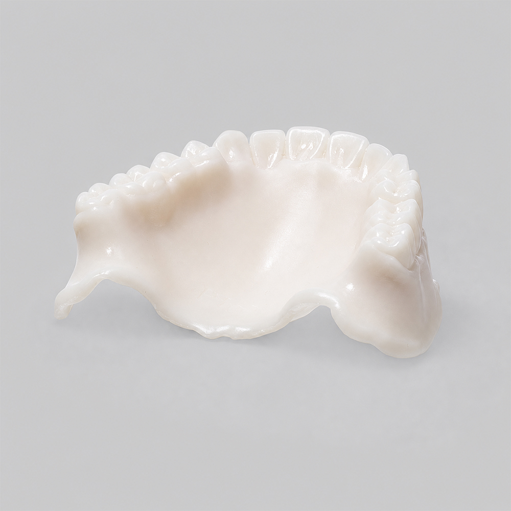 Try-in Resin application 3