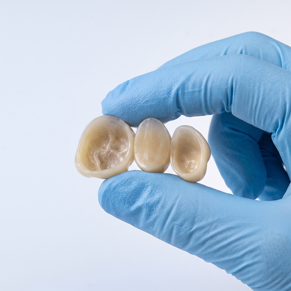 Ceramic Crown Resin application 3
