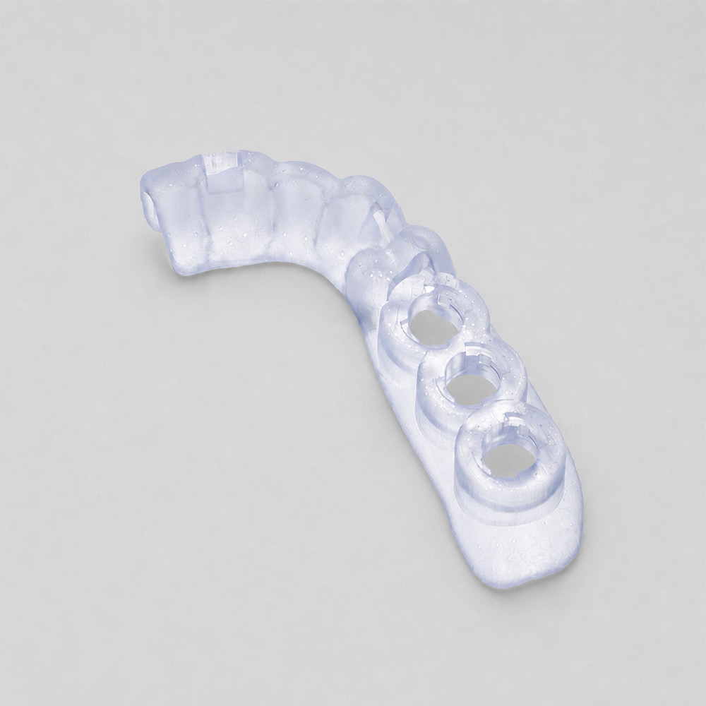 Surgical Guide Resin application 3