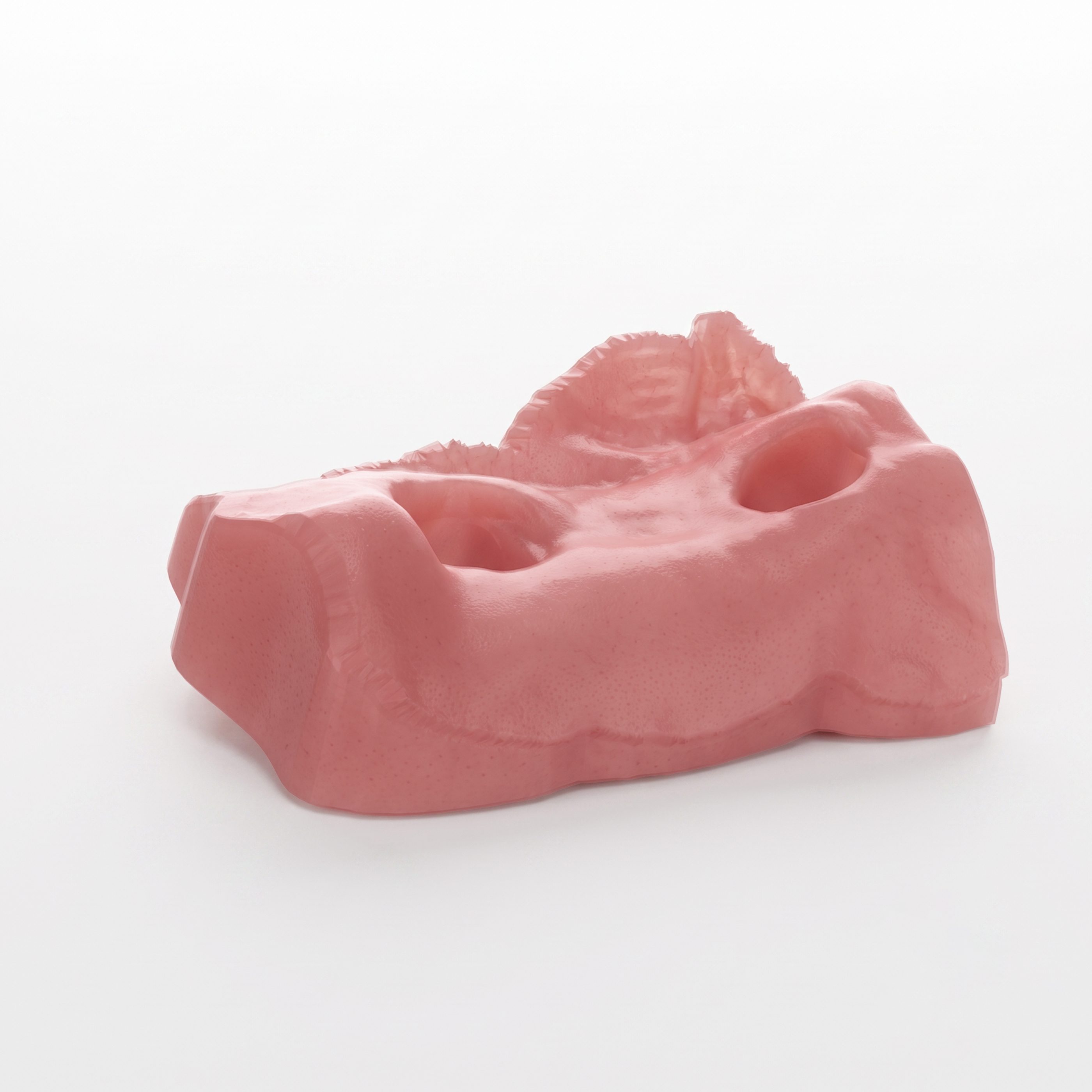Gingiva Resin application 1