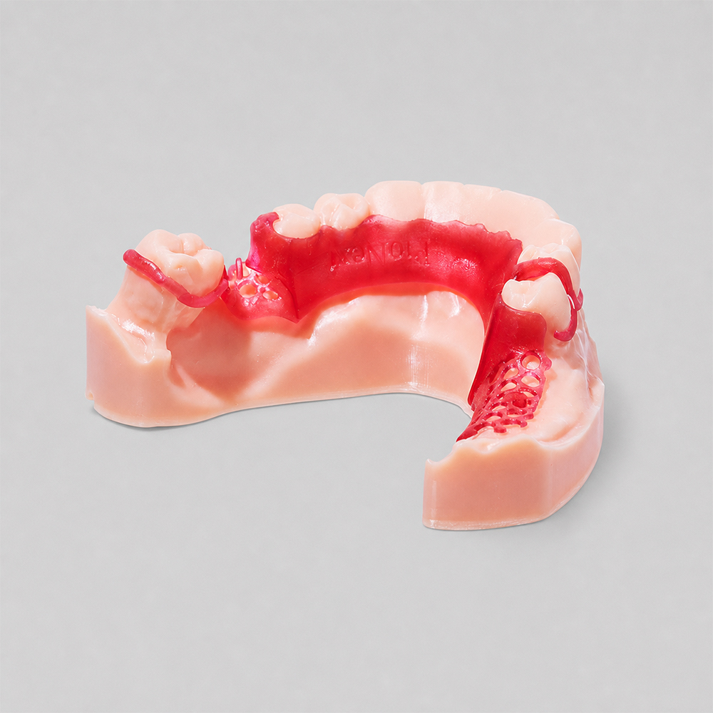 Dental Casting Resin application 2