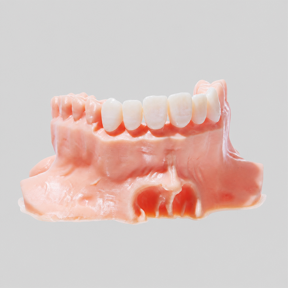 Removable Die Model Resin application 1