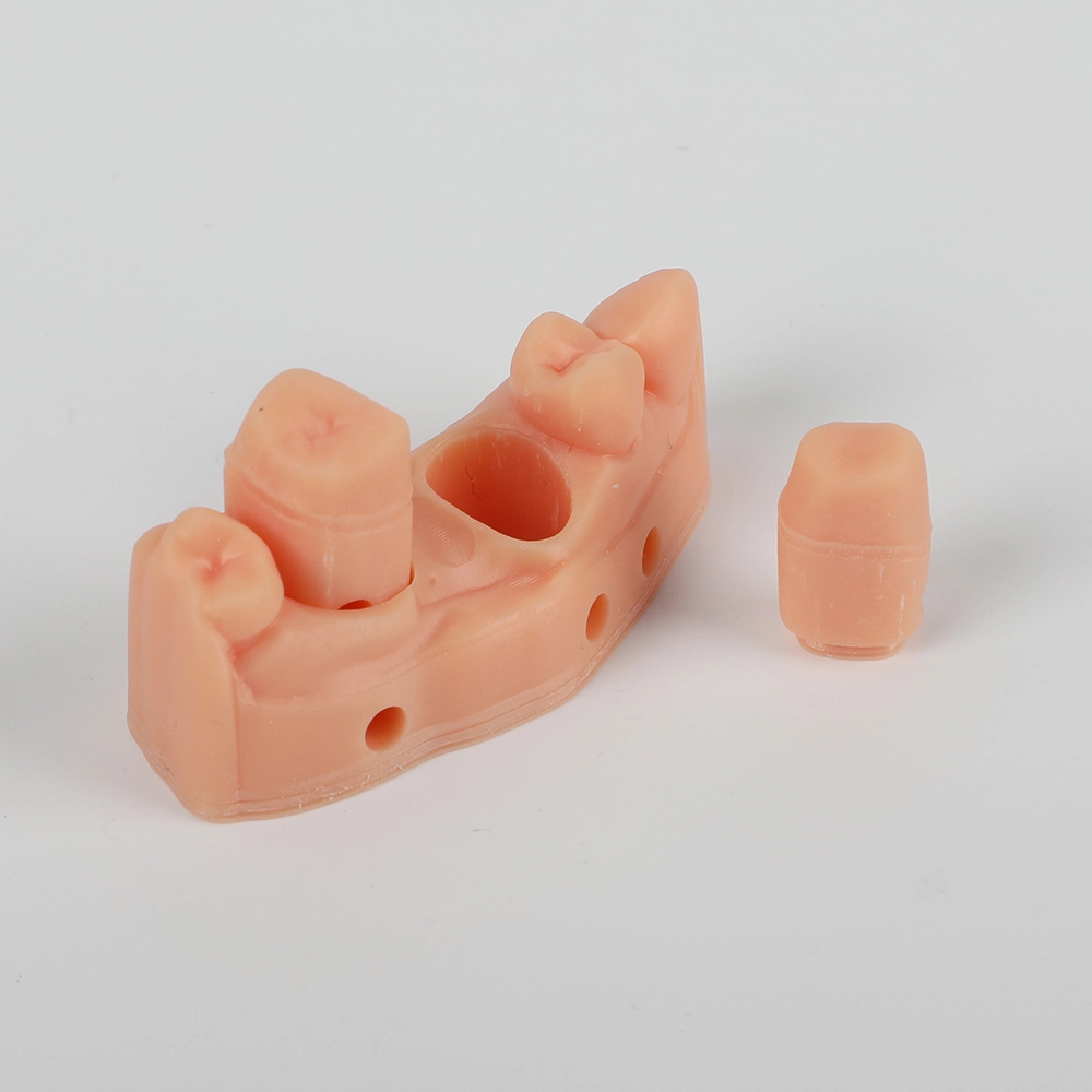Individual removable die beside a printed dental model
