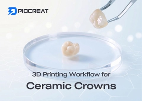 3D Printing Workflow for Ceramic Crowns