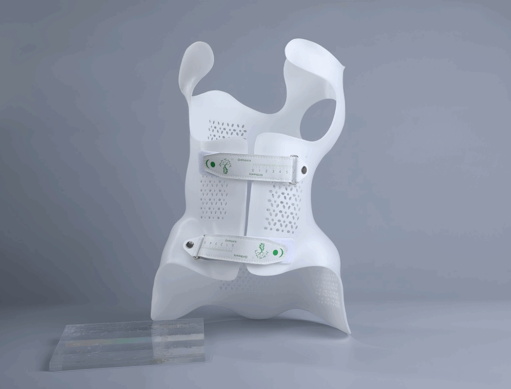 Rethinking Scoliosis Orthosis: How 3D Printing Transforms Comfort, Precision, and Efficiency