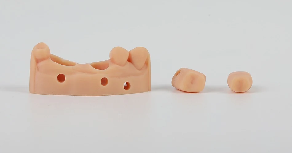 Printed dental model with two removable tooth dies