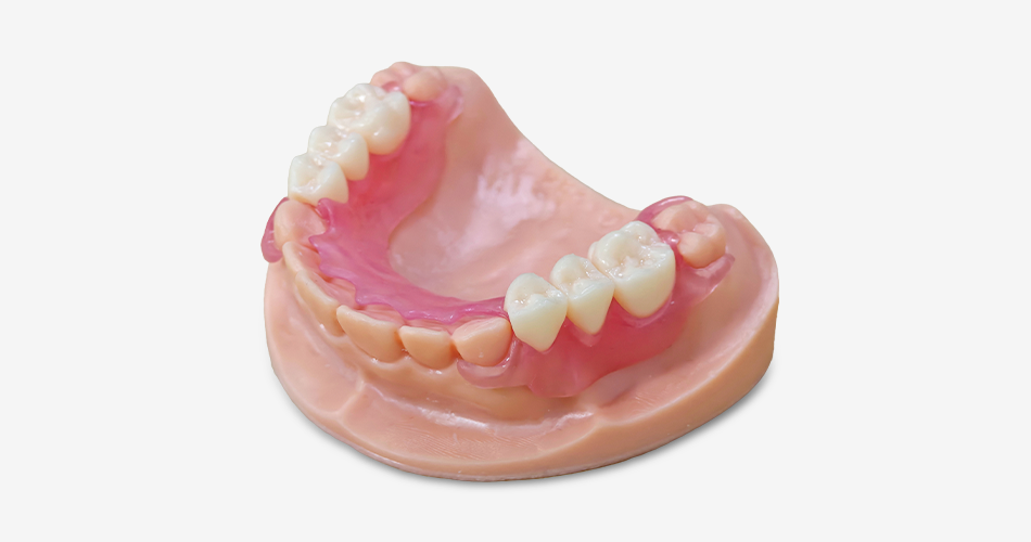 Dental arch model with a flexible partial denture